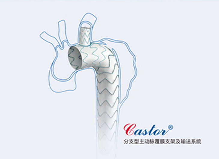 支架型腔内修复术(tevar)