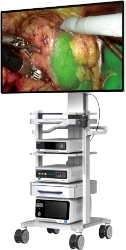 三维电子胸腹腔内窥镜系统III代